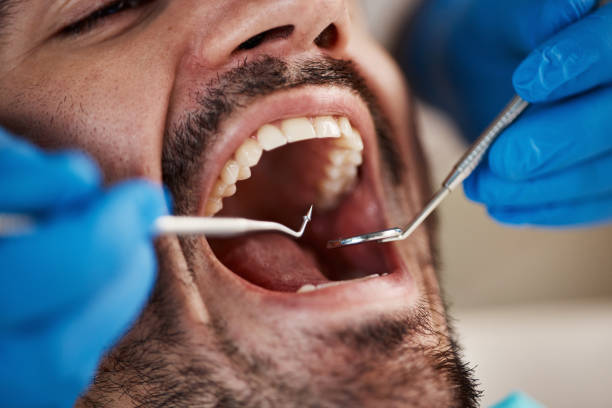Best Emergency Broken Tooth Repair in Noblesville, IN